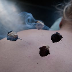 Gentle Point Acupuncture and Herbal Medicine