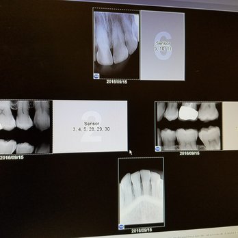 Anatoly Vaisman, DDS - The Choppers are doing great. - Cosmetic Dentists Near Me - San Fernando, California Anatoly Vaisman, DDS - The Choppers are doing great. - Cosmetic Dentists Near Me - San Fernando, California