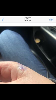 Providence Queen of the Valley Medical Center by null