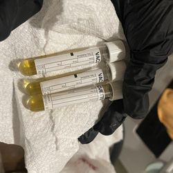 Queens Animal Hospital - Unlabeled containers of collected urine by us.