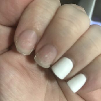 V Nails - Gel chipping off - Nail Salons Near Me - Miami, Florida