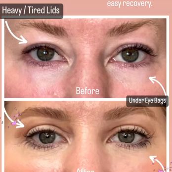 John A Vartanian, MD, FACS - Cosmetic Surgeons Near Me - Glendale, California John A Vartanian, MD, FACS - Cosmetic Surgeons Near Me - Glendale, California