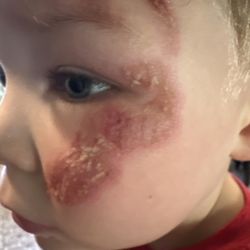 Just 4 Kids Urgent Care - This is how bad he got hurt.