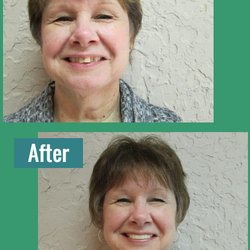Advanced Denture Care and Lab - Your spirit shows through your new smile!
