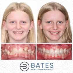 Bates Family Orthodontics