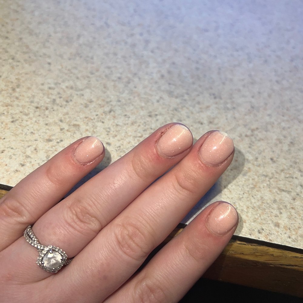 Two middle fingers are chipped Two middle fingers are chipped
