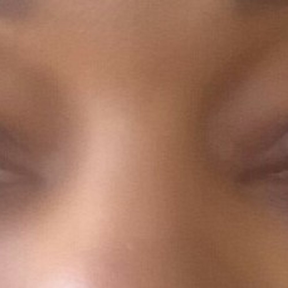 Amazing Lash Studio - My eyes remained inflamed for weeks. - Eyelash Service Near Me - Orland Park, Illinois Amazing Lash Studio - My eyes remained inflamed for weeks. - Eyelash Service Near Me - Orland Park, Illinois