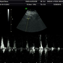 Sneak A Peek Imaging - Gender Check Houston Tx, 2D Ultrasound in Houston