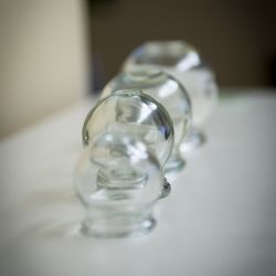 White Peony Acupuncture - Glass cups