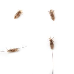 LiceDoctors - Baton Rouge - Magnified head lice; they use the hair as a ladder to the scalp.