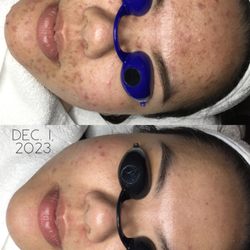 Clear Day Acne Clinic