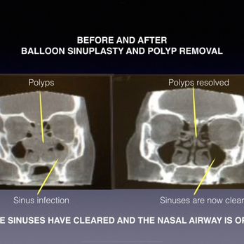 Sinus & Snoring Specialists - Ear Nose & Throat Near Me - Austin, Texas
