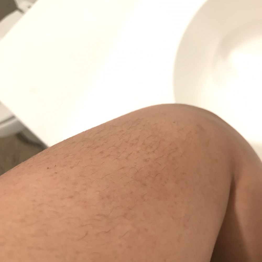 New Life Spa - Terrible job of waxing - they did not remove hair properly. - Skin Care Near Me - Newark, California