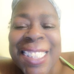 Florence Dental Group - Teeth extraction with polishing