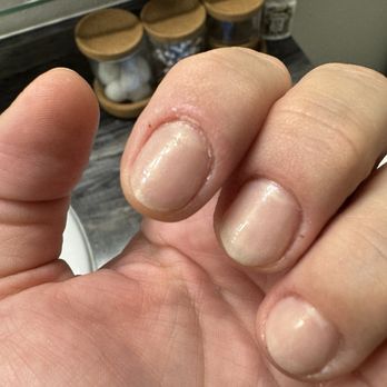 Sunny Nails - Gross worst manicure !!! - Nail Salons Near Me - Jacksonville, Florida