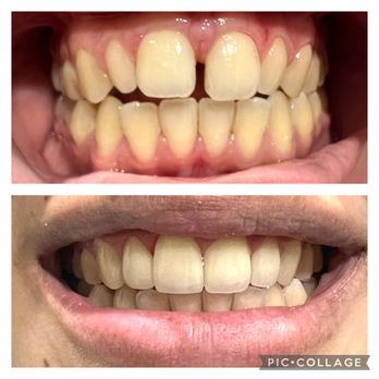 DJ Dental Group - Cosmetic Dentists Near Me - La Palma, California DJ Dental Group - Cosmetic Dentists Near Me - La Palma, California