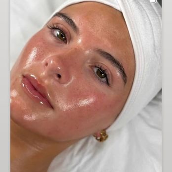 Skinovatio - Medical Spas Near Me - Houston, Texas Skinovatio - Medical Spas Near Me - Houston, Texas