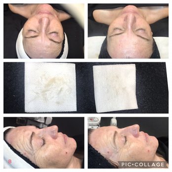 Divine Beauty and Style - Dermaplaning Facial - Skin Care Near Me - Brighton, Colorado
