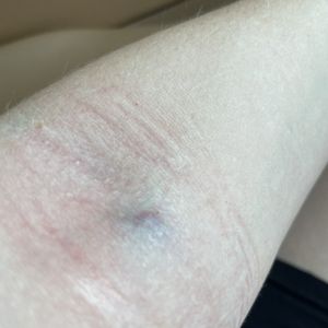 LABCORP - Updated September 2025 - 14 Reviews - 7000 SW 62nd Ave, Miami ...