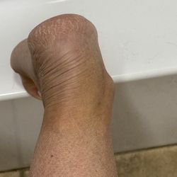 Lucent Nails Spa - This is my heel after paying for a callus removal imagine