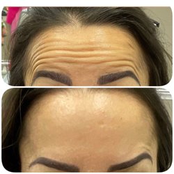 Mariam’s Aesthetic Clinic - Botox
