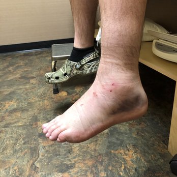 FastMed Urgent Care - Possible broken ankle - Urgent Care Near Me - Hendersonville, North Carolina