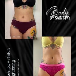 Body By Saint Ivy - Destroy stubborn fat with Cavi-Lipo and RF Skin Tightening. For more information head over to Instagram: BodyBySaintIvy