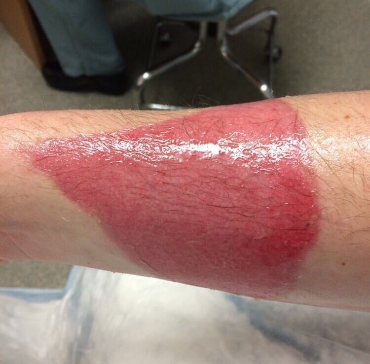 UCI HEALTH REGIONAL BURN CENTER Updated August 2024 101 The City Dr