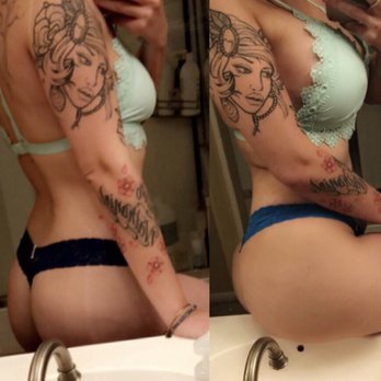 Devine Image - Procedure : Mastopexy & Breast Aug with 460cc implant. IN LOVE !!! - Medical Spas Near Me - Tustin, California