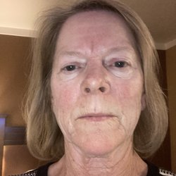 MCGoldSkinCare - Before the facial