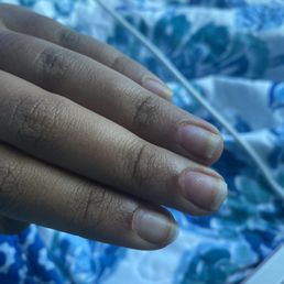 top view where you can see how uneven the thickness of my real nails are