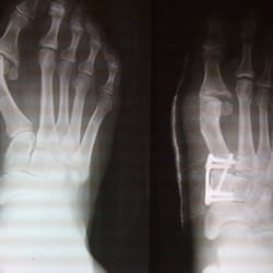 Before and After