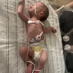 These pictures are after we had to take a ambulance right to nortons childrens after a potential seizure and failure to thrive.