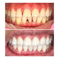 Jeannie A. Molato,DMD -Laser Dental Bakersfield