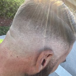 Skin fade