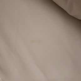 Stain on the sheets.