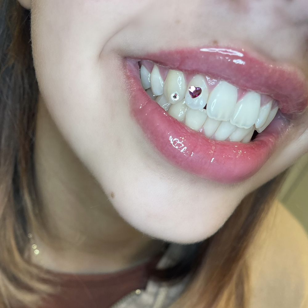 Bustdown Tooth Bling Logo