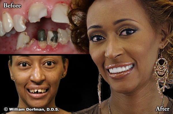 BILL DORFMAN, DDS - CENTURY CITY AESTHETIC DENTISTRY - Updated July