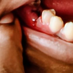 Temple University Dental School Clinic