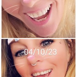 Moultrie Dental Care