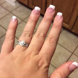 Acrylic fill. Acrylic fill.