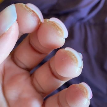 New Style Nails - Literally 10 days later all of my nails look like this - Nail Salons Near Me - Northridge, California New Style Nails - Literally 10 days later all of my nails look like this - Nail Salons Near Me - Northridge, California