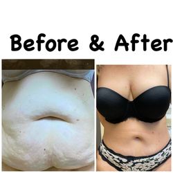 Aura Skin and Plastic Surgery - Results can't lie!