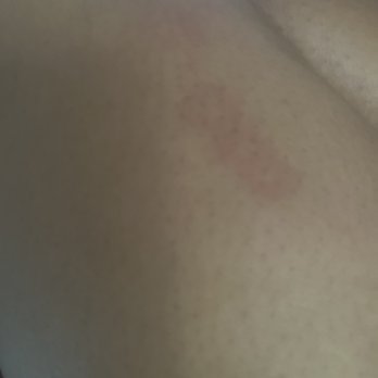 Club Quarters Hotel Downtown, Houston - Bed bug bites - Hotels Near Me - Houston, Texas Club Quarters Hotel Downtown, Houston - Bed bug bites - Hotels Near Me - Houston, Texas
