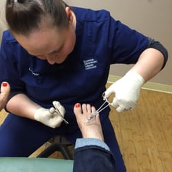 Chang Thomas DPM - Right foot stitches removal