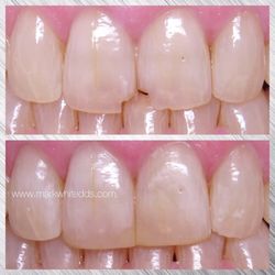 Mark White, DDS - Valley Dental Associates