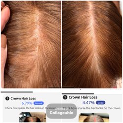 Jen Hastings scalp wellness and Trichology - Progress after hair loss treatments in Salon