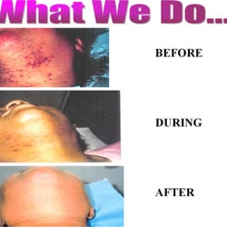 Epilation Clinic
