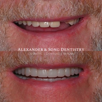 Alexander & Song Dentistry - Cosmetic Dentists Near Me - Carrollton, Texas Alexander & Song Dentistry - Cosmetic Dentists Near Me - Carrollton, Texas