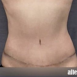 Alan N Larsen - Buckhead Plastic Surgery